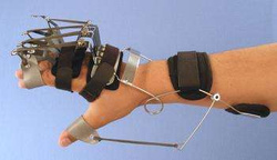Combination of coiled spring wire Oppenheimer to dorsiflex the wrist with composite elastic splint to extend the MP and PIP joints