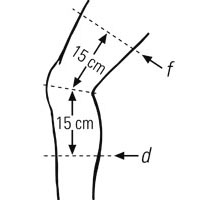 BORT Select StabiloGen®