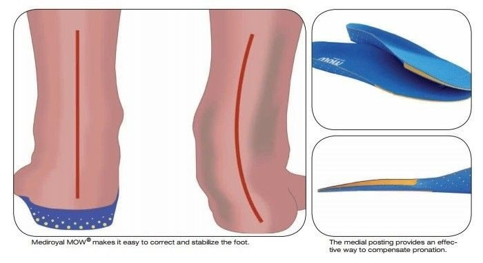 Medial orthotic wedge insoles NOW 