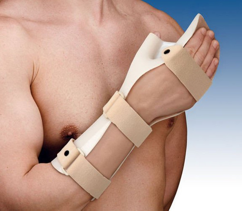 Orliman hand immobilization splint in functional position