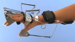Combination of coiled spring wire Oppenheimer to dorsiflex the wrist with reverse knuckle bender to extend the metacarpophalangeal joints