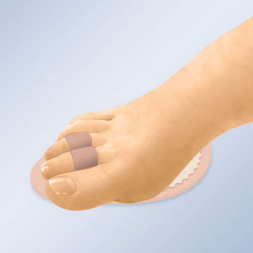 Orliman GL 205 splint to relieve pain caused by axial deviation, fractures or hammer toe